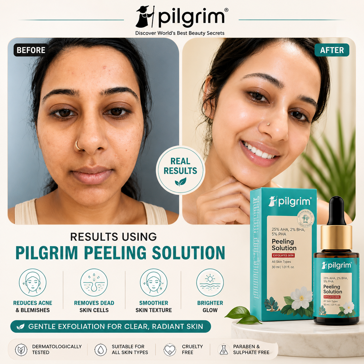 25% AHA, 2% BHA, 5% PHA Peeling Solution